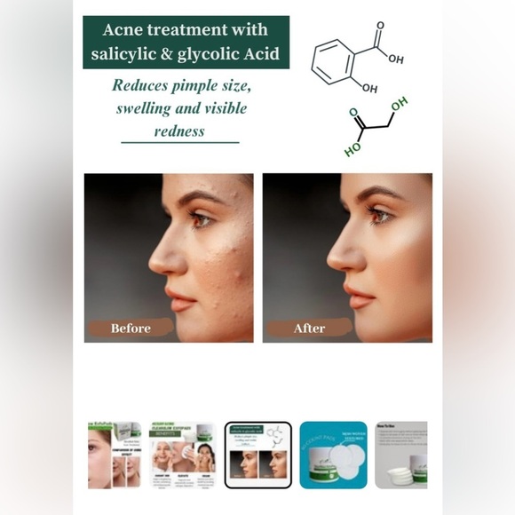 ClearGlow ExfoPads - Green - Picture 4 of 8